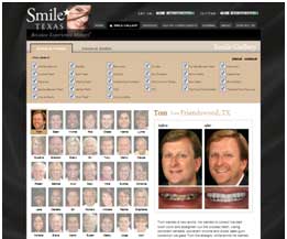 smiletexas.com dynamic smile gallery